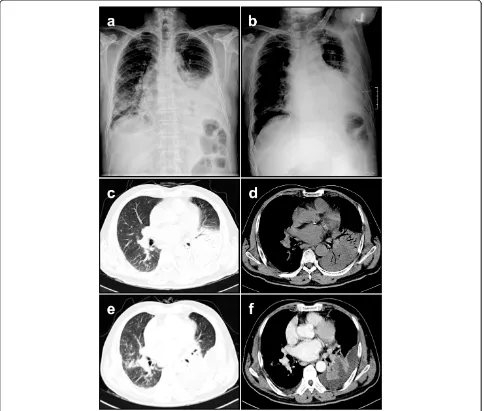 Fig. 1 Chest X-ray and chest computed tomography (CT) findings in M. lentiflavum-infected patient