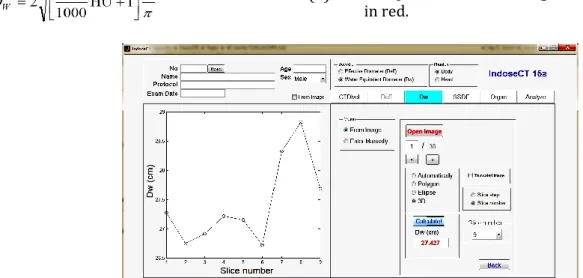 Figure 2 shows the profile tube current along the  longitudinal  axis  and  the  average  value  of  tube  current (next to TCM button)