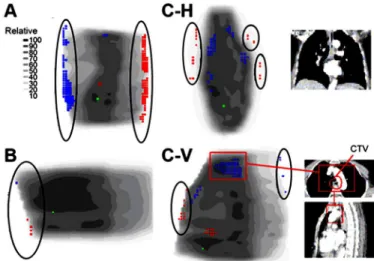 Figure	 1-C-H	 and	 1-C-V	 illustrate	 the																					 horizontal	 and	 vertical	 sections	 from	 a	 patient	