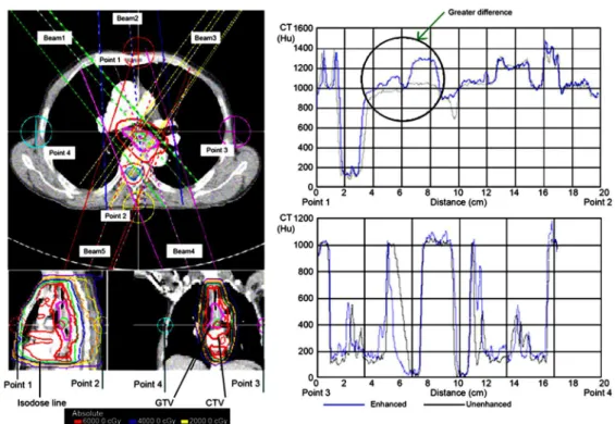 Figure 2. Computed tomography (CT) value distribu ons in the superior-posterior and le -right direc ons across the isocentre