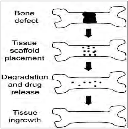 Figure 1.1: Biodegradable, polymeric scaffold 