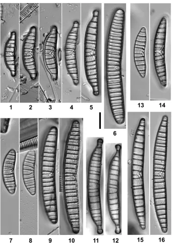 Figure 3. LM pictures of Epithemia taxa recorded in samples collected from different macrophytes