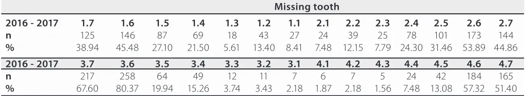 Table 3. Prevalence of partial edentulism in upper jaw according to the Kennedy and Applegate classification in patients treated at the Dental Clinic of Universidad San Martín de Porres University - North Campus, in the years 2016 and 2017 according to sex.