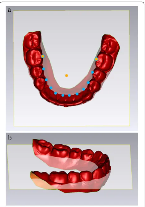 Figure 2 An occlusal view (a) and a lateral view (b) ofreference plane.