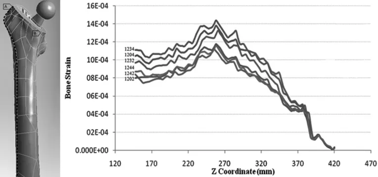 Figure 11. Equivalent von Mises μstrains along Z Axis – Profile line along the femur length including the greater trochanter, lateral side