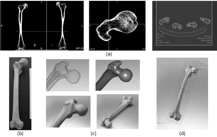 Figure 1. From Cadaveric Femur to CAD model: a) Step by step image processing of the CT scans using Mimics, b) Cadaveric Femur, c) Converting the derived point could to a 3D solid model, d) Digital Pre-operative Templating and dimensioning