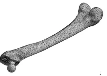 Figure 4. Full finite element model consisting of approximately 95.000 ten-node tetraedra elements