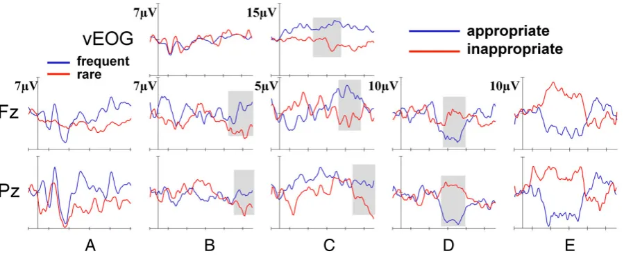 Fig. 3. Event-related potentials of the patient. (A) Oddball (day 6) shows a P1-N1-P2 complex, but the P3-like shift at Pz isthe two critical conditions (responses to semantic stimuli in coma) vertical EOG traces are also presented for comparisonwith ERP w