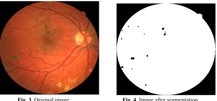 Fig. 3. Original image                                     Fig. 4. Image after segmentation 