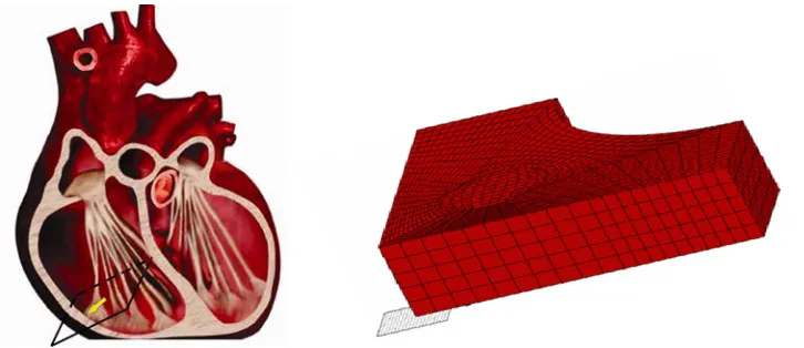 Fig. 1. The pathways for insertion ncatheter inside the heart 