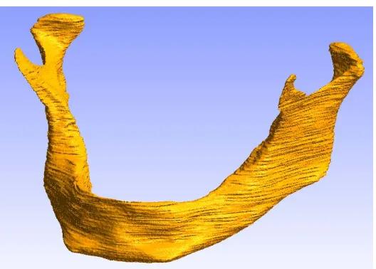 Fig. 5. Jawbone 3D reconstruction from Dicom CT slices 