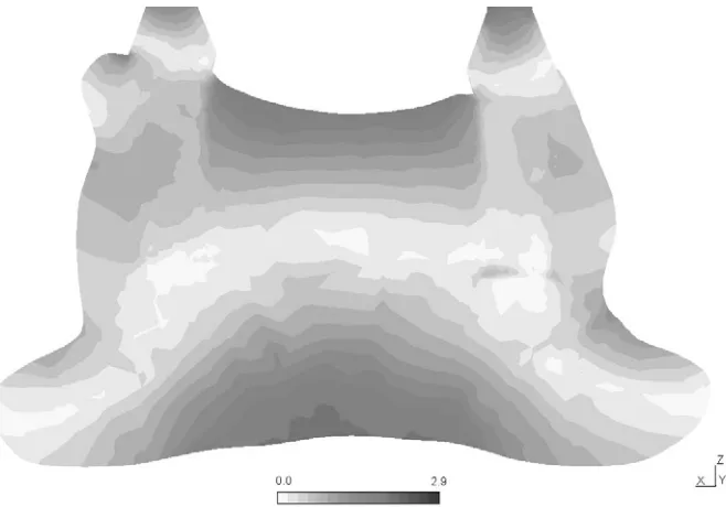 Fig. 10. Effective stress distribution (units MPa) for the cross-section along 35 degree implant, loaded by force of 100 N