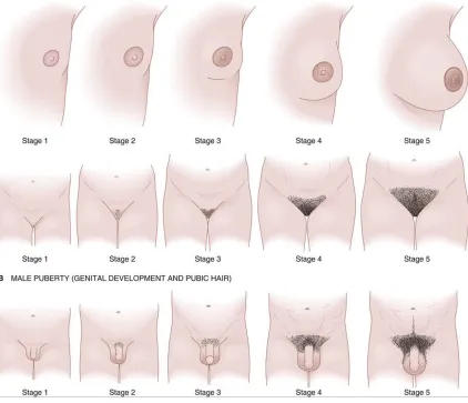 Figure 1.1 Tanner stages of development for males and females ([Tanner stages of puberty based on pubic hair, genital, and breast development in boys and girls]