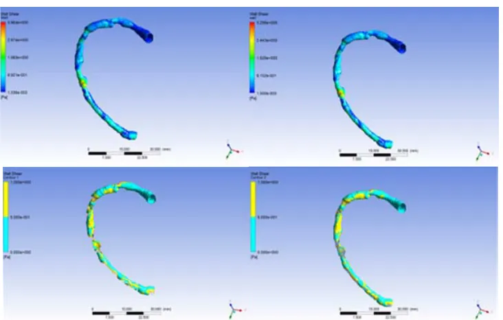 Fig. 3. Calculated WSS distribution for the FSI (top left) and rigid wall (top right) simulations