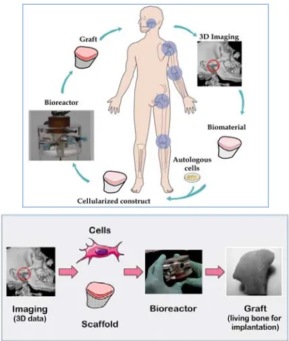 Fig. 3. Personalized bone grafts. To precisely reconstruct the shape and structure of native bioreactor chamber are guided by imaging