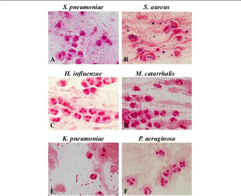 Figure 1 Bacterial morphotypes in sputum Gram stain (×100, oil immersion field).coccobacilli are suggestive ofPlump Gram negative rods are suggestive of Gram positive diplococci (lancet-shaped or football-shaped)are suggestive of Streptococcus pneumoniae (