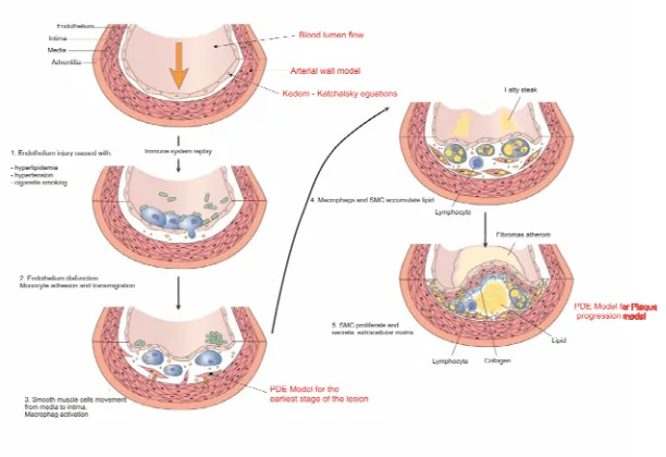 Fig. 1. Atherosclerotic plaque development (adapted from [Loscalzo J.and Schafer A. I., 2003]) 