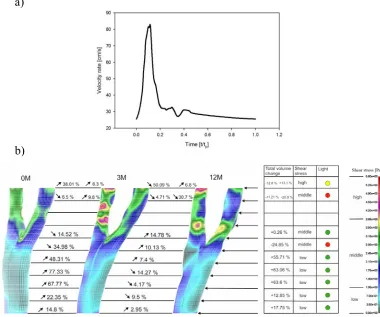 Fig. 6. Computational results: a) Dimensionless wall LDL concentration profile in the media; b) Oxidized LDL concentration profile in the media, r is radial position at the cross section [mm] 