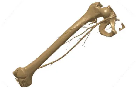 Fig. 1. Polygonal model of femur before cleaning 