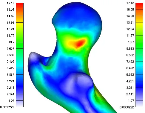 Fig. 5. FE model of femur with boundary condition 