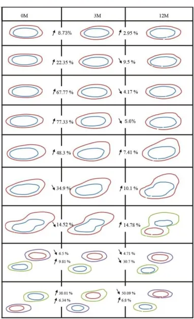 Fig. 2b. Cross-section areas vs time (0, 3 and 12 months) for patient #1 