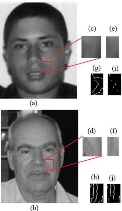 Figure 6. Extracting cheekbone wrinkles 