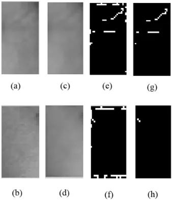 Figure  7  illustrates  the  process  of  eye  corner  wrinkle  density  calculation  and  compares  this  process in a 24 years old person with a 52 years old person