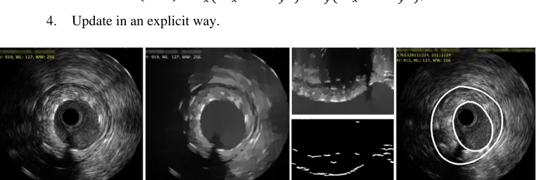 Fig. 3. Ivus segmentation; initial image, midresults after enhancing, polar gradients and resulting contours 