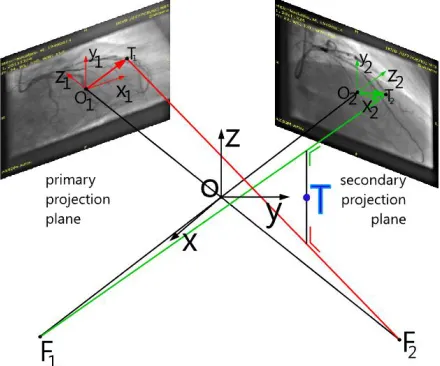 Fig. 4. Transformation matrix for reconstructing catheter path from angiography 