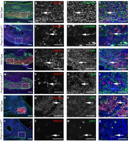 Figure 4.4 POU1F1 is expressed in cells that maintain β-CATENIN expression. [A-H] POU1F1 [red and B, F] and β-CATENIN [green and C, G] double immunostaining on e14.5 coronal sections