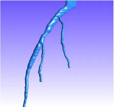 Fig. 1. Three-dimensional reconstructed model of an arterial tree. The location of the stenotic segment where stent was deployed