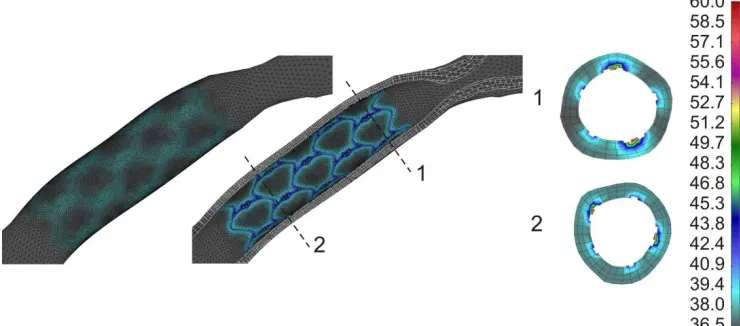 Fig. 5. Effective stress distribution in the two different cross-section locations inside the arterial wall at the end of stent deployment