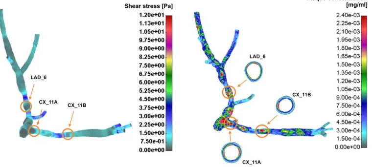 Fig. 3. Baseline and follow-up for plaque position at CX and LAD 