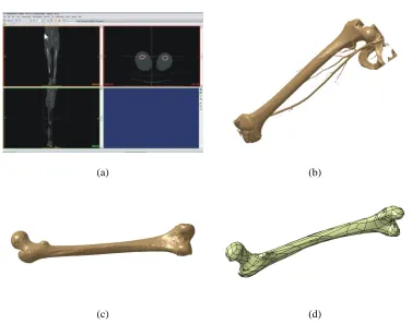 Fig. 5. Basic scheme of software system for the creation of customized bone polygonal model (Vitković et al