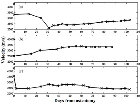 Fig. 2. Three velocity evolution patterns corresponding to: (a) secondary healing, (b) primary healing, and (c) delayed union (Protopappas et al