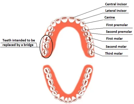 Fig. 1. Types of natural teeth. 