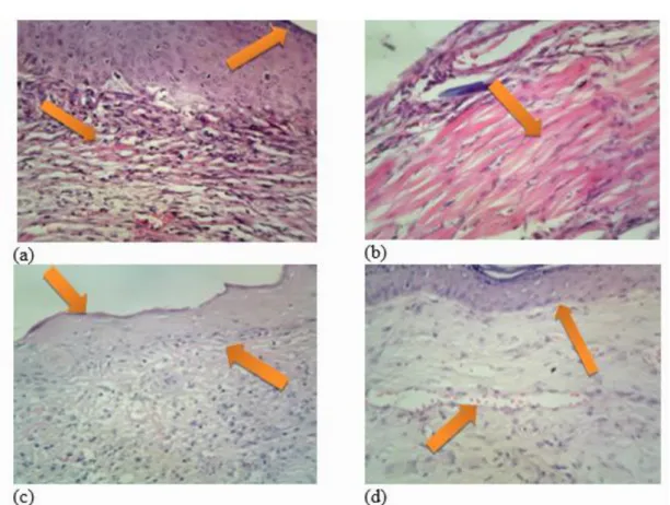 Figure 3. (H &amp; E stain) Photomicrographs of skin samples (magnification 40 X): (a) The group 1, formation of  vascular tissue and epidermis, (b) The group 2, severe secretion of red blood cells as a result of inflammation,  (c)  The  group  3,  agglome