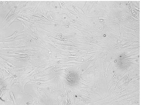 Figure  1.  The  isolated  cells  (MSCs)  were  observed  under  inverted  microscope  and  were  spindle-shape  and  adherent (100 x)