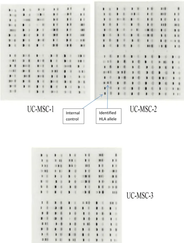 Figure 3. HLA-genotyping results using PCR-SSP kits for three umbilical cord MSCs after electrophoresis
