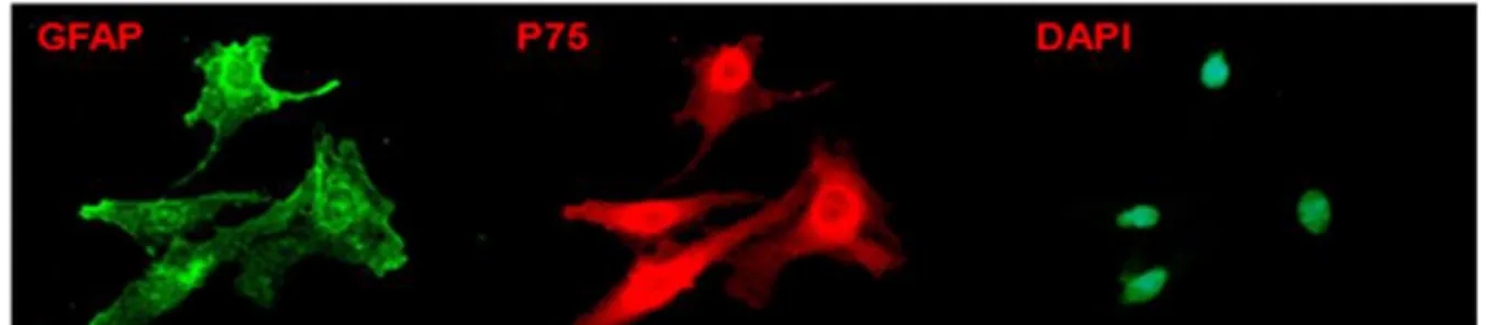 Figure 2. Simultaneous double staining (Immunocytochemistry (ICC)) for p75 and GFAP markers of  cultured  OECs  ,  p75 + /GFAP +   are  double  positive  cells  for  p75  and  GFAP  markers  at  the  same  time