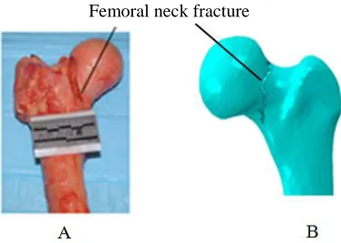 Fig.10. Comparison of the fracture location of the simulation (B) with the experimental results (A) 