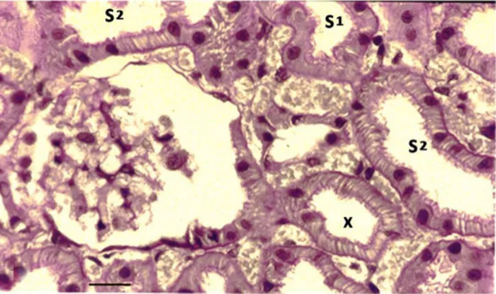 Figure 5. A PAs-stained freeze-substituted normal kidney showing a juxtamedullary nephron.Notes: The cells in the proximal tubular loop (X), descending from the glomerulus, have a typical s2-like structure
