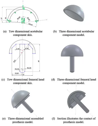 Fig. 1. Geometry and model of CF/PA12 composite Hip resurfacing prothesis components. 