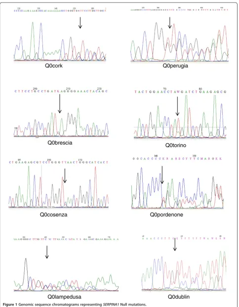 Figure 1 Genomic sequence chromatograms representing SERPINA1 Null mutations.