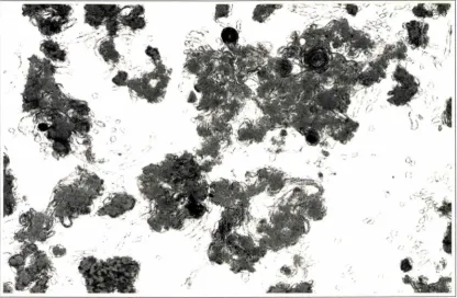 Figure 6-5: Electron Micrograph of Liposomes Made From Liver Phospholipids and Subunit c Proteolipid (20: 1) x 33,500