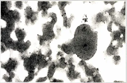 Figure 6-8: Electron Micrograph of Liposomes made from Egg Phospholipids and Subunit c Proteolipid (1: 1) Showing a "Lipid-droplet" like Structure (arrow) x 33,400