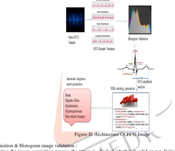 Figure II: Architecture Of ECG Image  