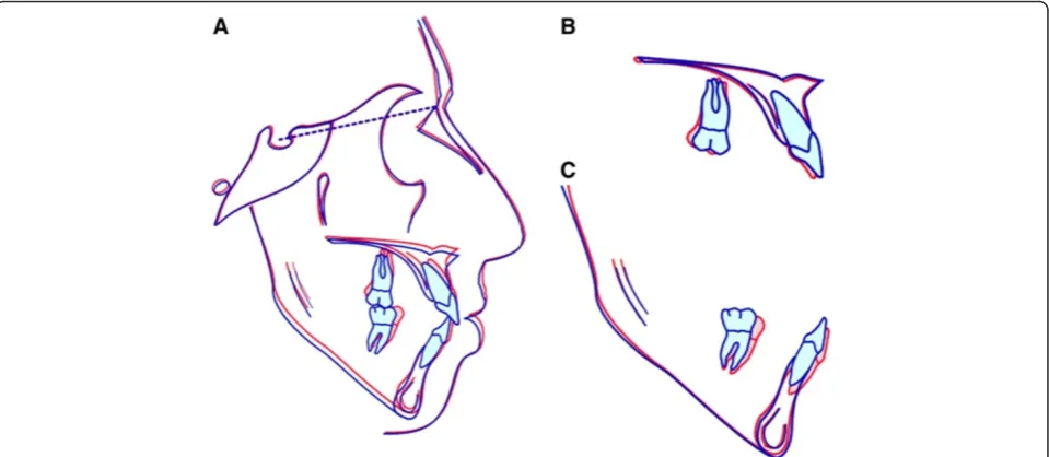 Figure 8 Posttreatment digital dental casts.