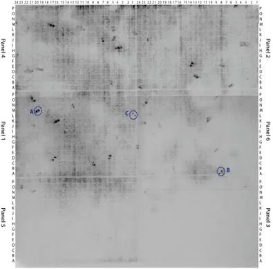 Figure 2.11: Gorilla BAC library filter CHORI-255 1A with signals for the rDNA positive BAC clones