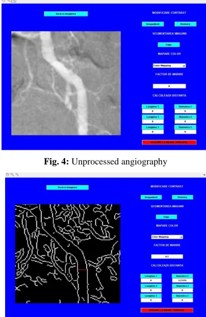 Fig. 1: Modeling and simulation of vascular architecture  